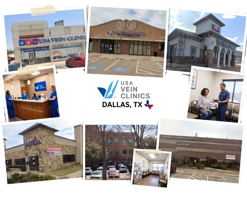 Dallas Vein Centers