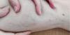 Why Are My Veins So Visible?
